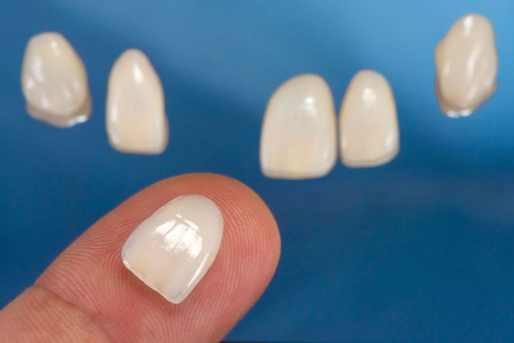 Veneers in background and veneer on fingertip