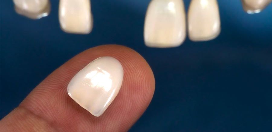 Veneers in background and veneer on fingertip